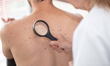 Dermatolog hastanın cildini inceliyor.