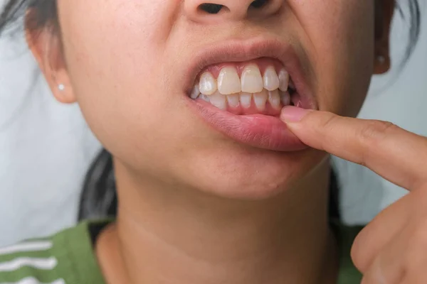 Mulher Asiática Segurando Mão Bochecha Sentindo Dor Dente Cárie Dentária — Fotografia de Stock