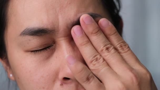 Junge Frau Leidet Unter Augenschmerzen Stauballergie Trockenen Augen Tränenden Augen — Stockvideo
