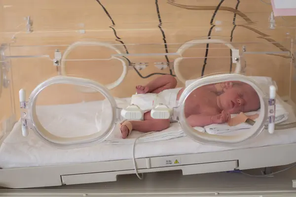 Premature Newborn Baby Hospital Incubator Neonatal Intensive Care Unit — Stock Photo, Image