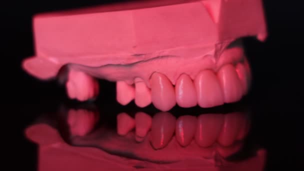 Zahngesundheit Keramisches Zirkonium Aus Nächster Nähe Zahnersatz Auf Zirkonoxid Implantaten — Stockvideo