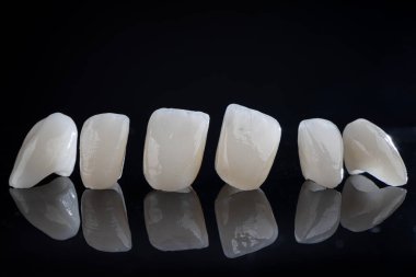 Siyah arka planda seramik takma dişler ve taçlar. Diş sağlığı hizmetleri. Son sürümde seramik zirkon.
