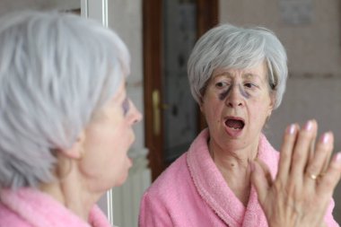 Banyoda aynanın önünde estetik ameliyat sonrası morlukları olan olgun bir kadının yakın plan portresi.