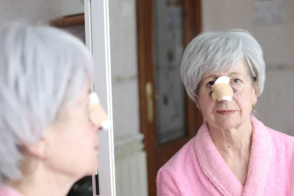 Крупным Планом Портрет Зрелой Женщины Бинтом После Пластической Операции Носа — стоковое фото