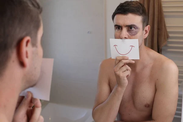 stock image portrait of young man with black eye in front of mirror