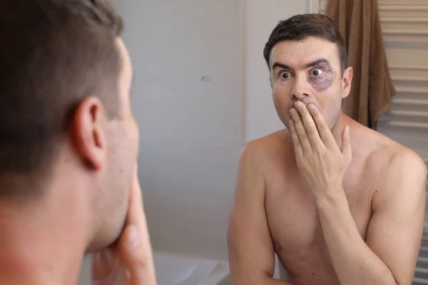 Porträt Eines Jungen Mannes Mit Blauem Auge Vor Dem Spiegel — Stockfoto