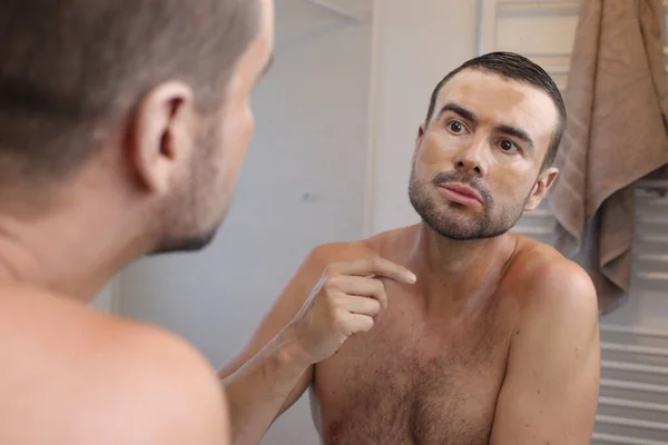 Retrato Hombre Joven Con Vitiligo Delante Del Espejo Baño — Foto de Stock