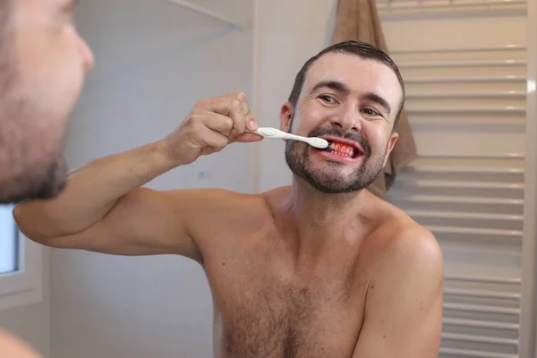 Potret Pemuda Dengan Gusi Berdarah Menggosok Giginya Depan Cermin Kamar — Stok Foto