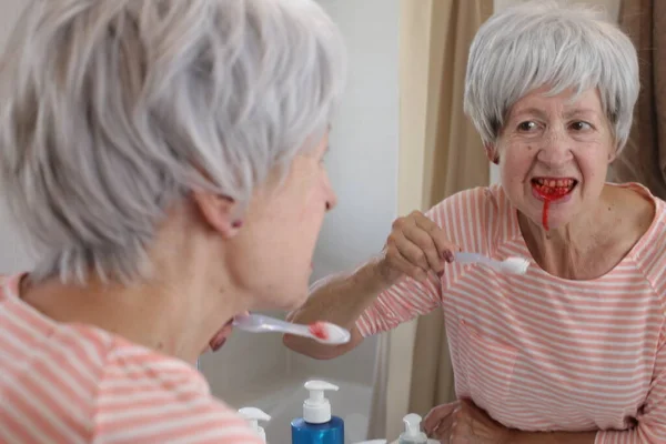 Nahaufnahme Porträt Einer Reifen Frau Mit Blutendem Zahnfleisch Während Sie — Stockfoto