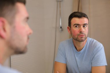 Yüzünde kırmızı güneş yanığı olan yakışıklı bir adamın portresi. Banyoda aynanın önünde.