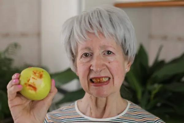 Retrato Mujer Madura Pelo Gris Con Encías Sangrantes Comiendo Manzana Fotos de stock libres de derechos