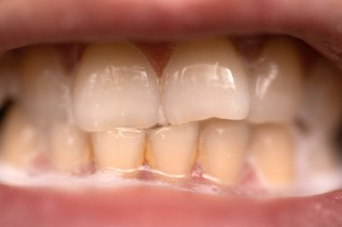 the process of using a toothbrush as a step in the daily procedure of brushing your teeth close-up