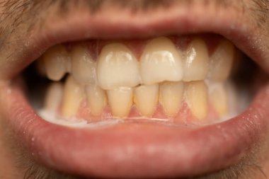 the process of using a toothbrush as a step in the daily procedure of brushing your teeth close-up
