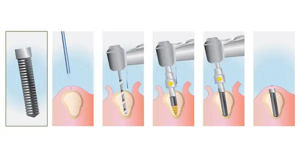 Renkli tıbbi biçim çizimi