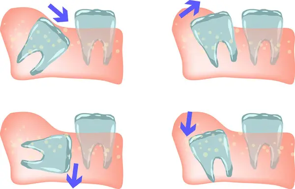 Diş illüstrasyonu, renk sağlık dosyası