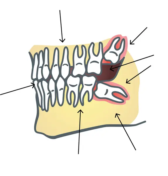 Diş illüstrasyonu, renk sağlık dosyası