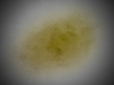 Beyaz bir dairede sarı bir madde.