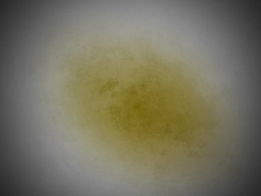 Beyaz kasede sarı bir madde.