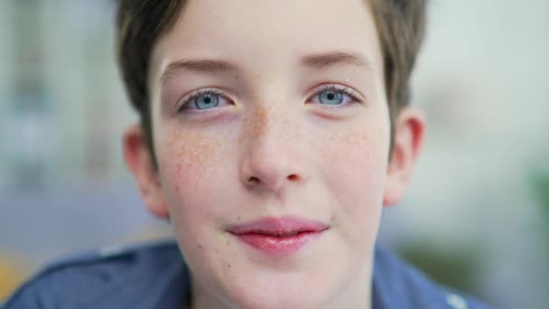 Retrato Divertido Adolescente Colegial Con Pecas Aparatos Ortopédicos Con Ojos — Vídeos de Stock
