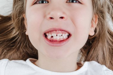 Happy smiling child portrait. Dental care, oral health. Close-up of teeth. Little todler attractive lovely sweet curious cheerful girl laughs with her teeth showing. White background