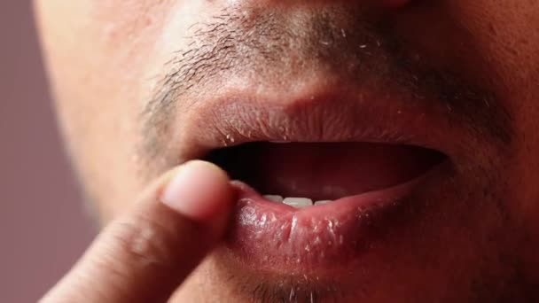 Close Dry Lips Indian Male Applying Moisturizer — Vídeo de Stock