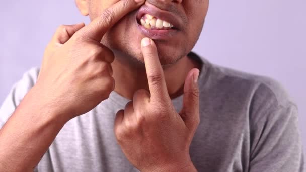 白い背景にインディアンによって示された不規則な歯のクローズアップ — ストック動画