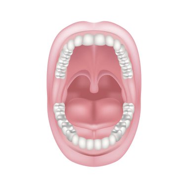 Short frenum of the tongue. Pathology of the oral cavity. Anatomy of the teeth. Vector illustration clipart