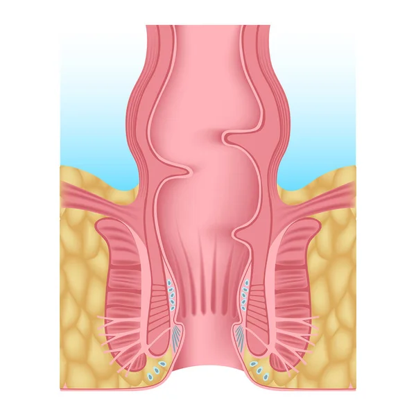 Anatomia Abertura Anal Humana Rectum Cartaz Médico Ilustração Vetorial —  Vetores de Stock