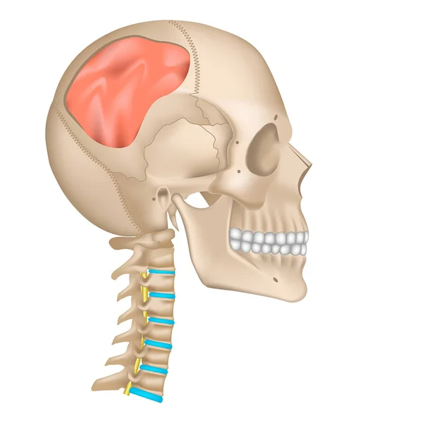 頭蓋骨への外傷 脳を持つ頭の中の穴 骨折だ ベクターイラスト — ストックベクタ