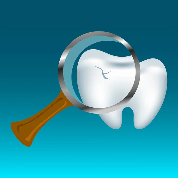 歯と虫眼鏡 エナメル質の亀裂 歯医者の診察 ベクターイラスト — ストックベクタ