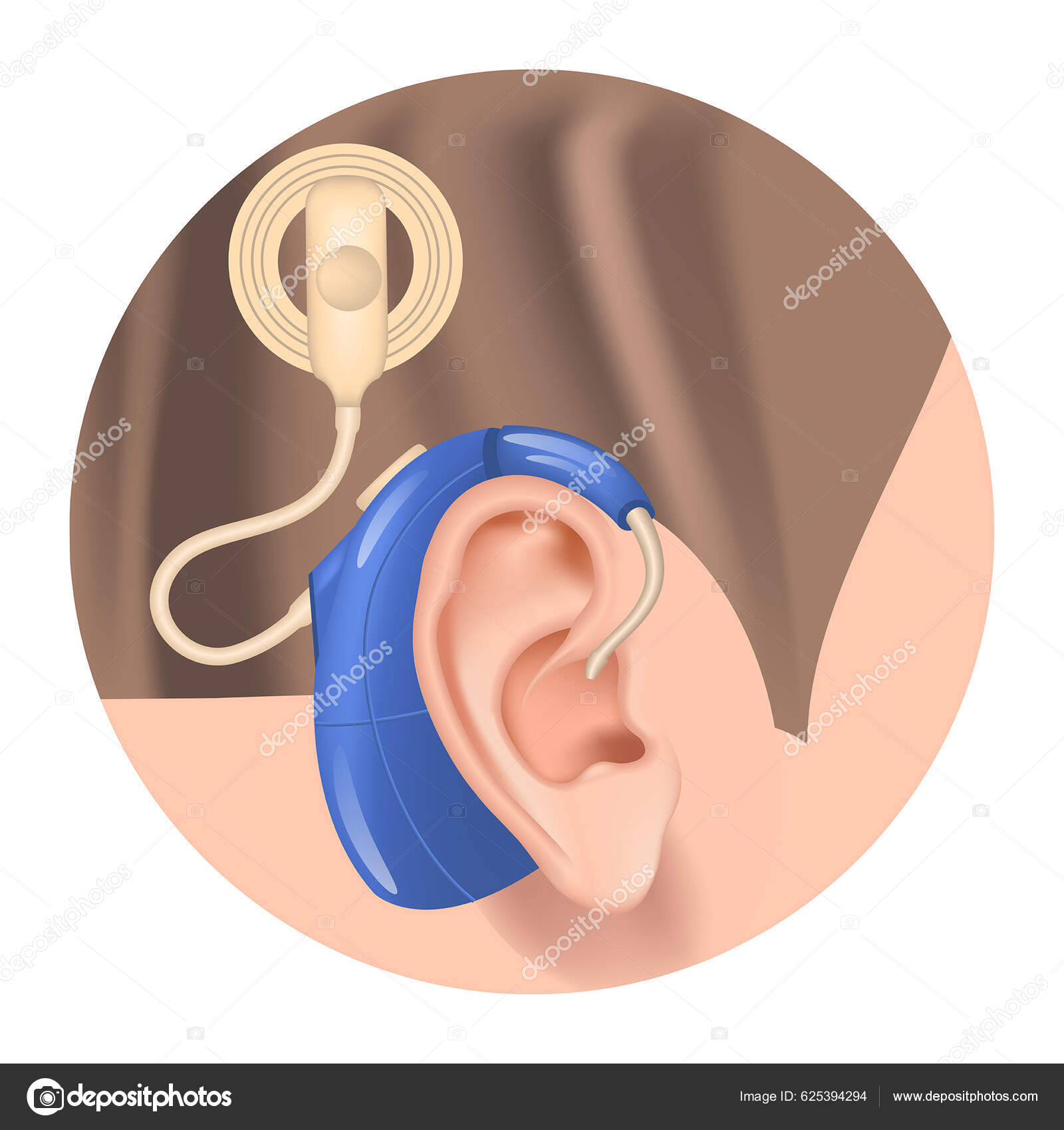 Κοχλιακό Εμφύτευμα Ακουστικό Στο Αυτί Αισθητηριακή Απώλεια Ακοής Θεραπεία  Κώφωση Διανυσματικό Αρχείο από ©ArtistUI625394294