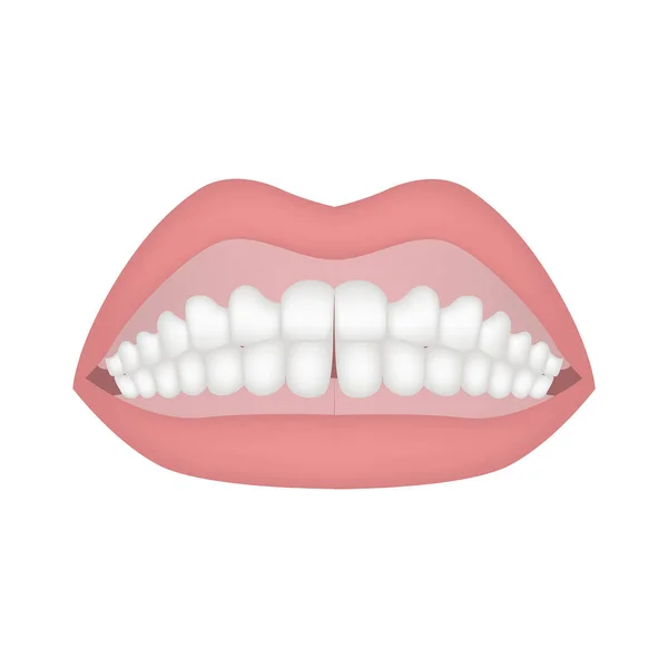Сжатые Белые Зубы Губами Деснами Векторная Иллюстрация — стоковый вектор