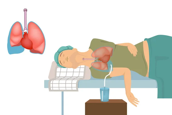 Épanchement Pleural Patient Avec Cathéter Dans Les Poumons Procédure Pompage — Image vectorielle