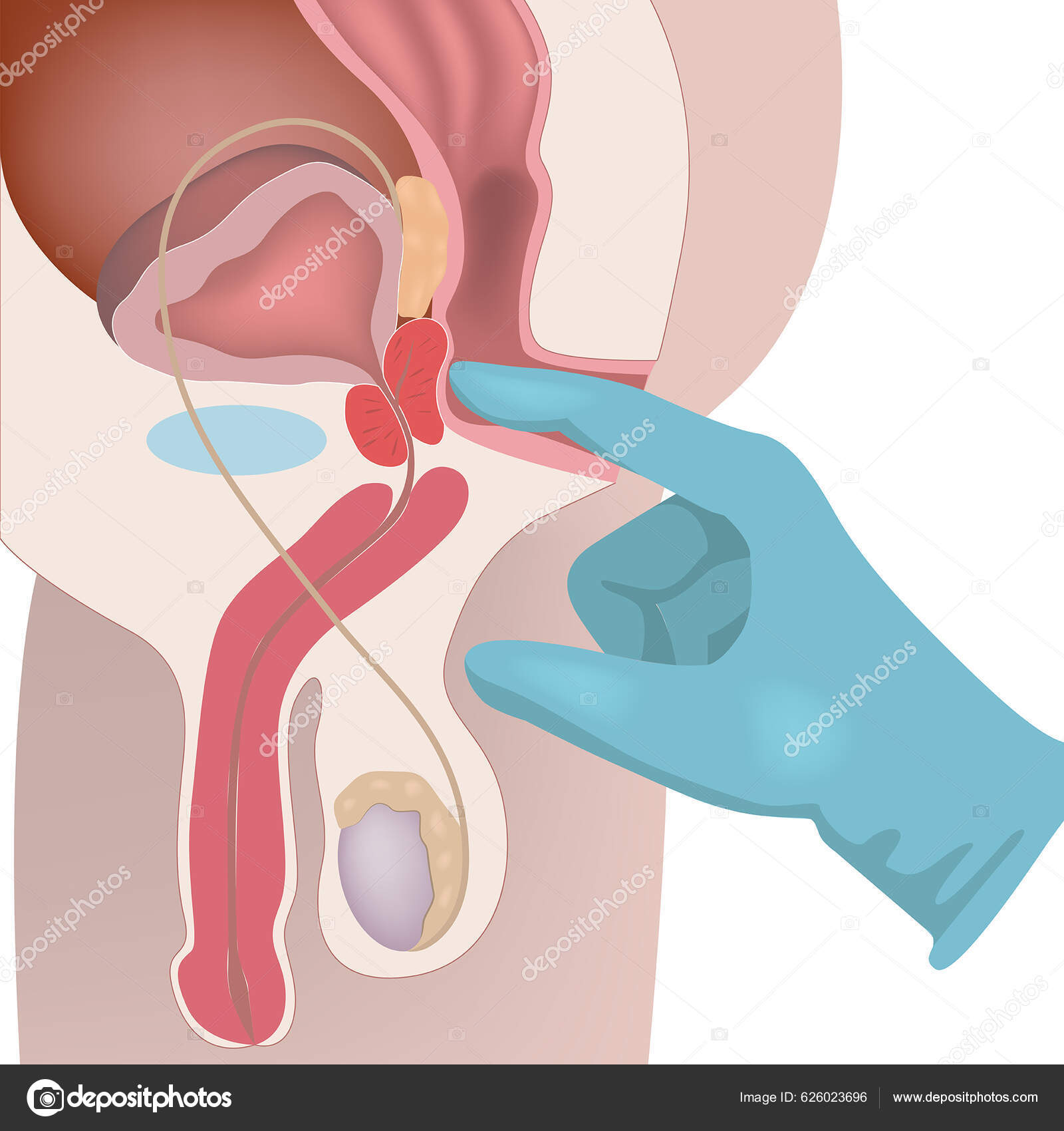 Sistema Reproductivo Hombre Palpación Masaje Próstata Diagrama Con Órganos  Internos Vector de stock #626023696 de ©ArtistUI