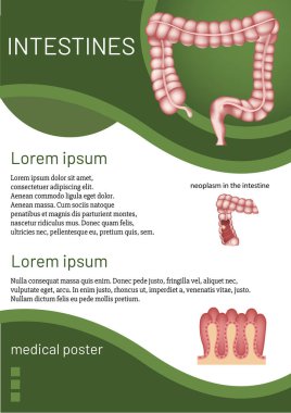 Bağırsak anatomisi ile ilgili tıbbi broşür. Vektör illüstrasyonu
