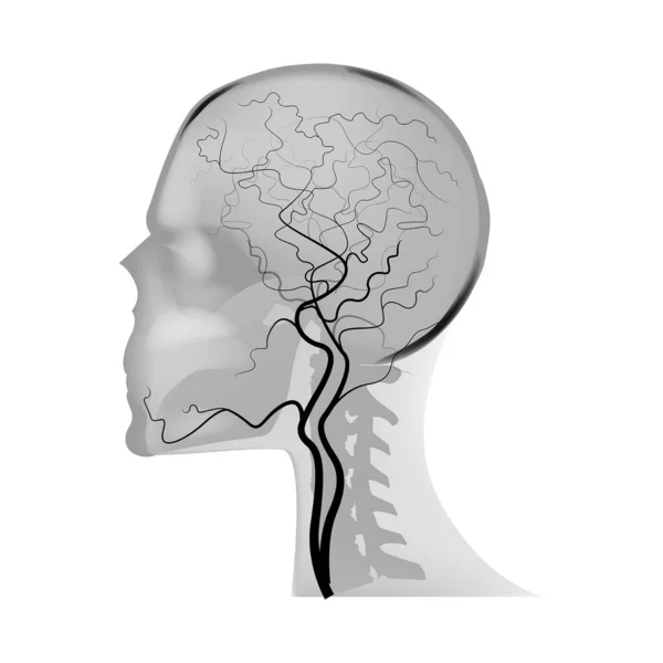 Angiografia Naczyń Mózgowych Rezonans Magnetyczny Ilustracja Wektora — Wektor stockowy