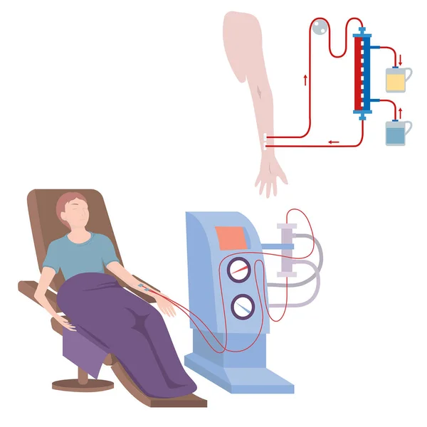 Patient Dans Chaise Est Connecté Machine Hémodialyse Purification Extrarénale Sang — Image vectorielle