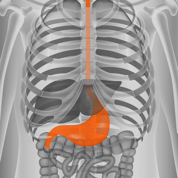 黒と白の人間の骨格を背景に赤い胃が炎症を起こした 体のレンダリング 医用ベクターイラスト — ストックベクタ