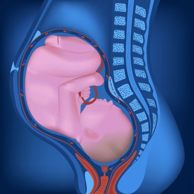 Rahminde fetüsü olan hamile bir kadın var. Ultrason için neon görüntüler, ilaç paketleri, site için afişler, ultrason muayenesi reklamları. Vektör illüstrasyonu