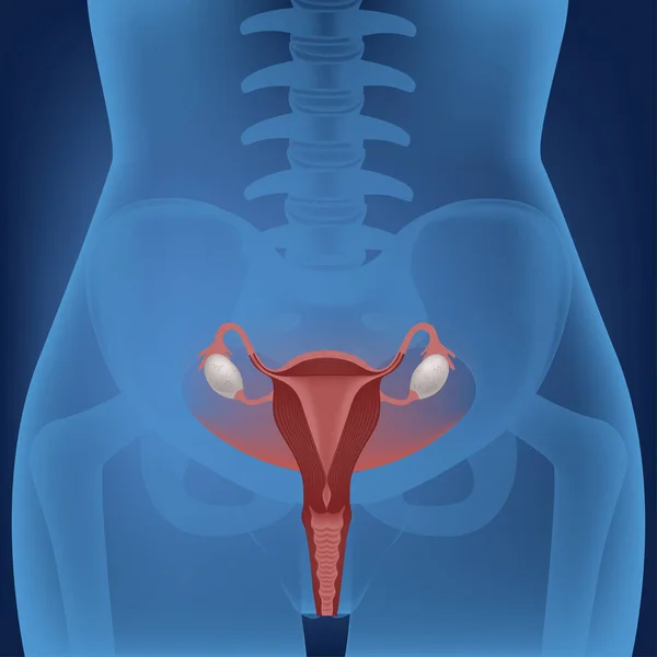 ネオンの背景 光の中の女性のトルコ 子宮の解剖学的構造 生殖システムです 医療ポスター ベクターイラスト — ストックベクタ