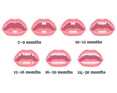 Çocuklarda süt dişlerinin büyümesinin aşamaları. Tıbbi geçmiş ya da poster. Vektör düz resimleme