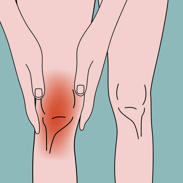 Lutut Terbakar Gadis Itu Memegang Tangannya Kakinya Poster Medis Ilustrasi - Stok Vektor