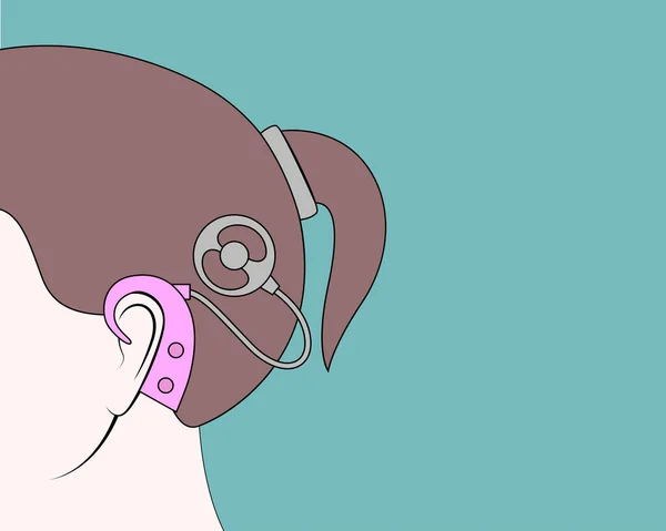 Implant Cochlear Głowie Dziewczyny Wykształcenie Medyczne Lub Plakat Wektor Płaska Grafika Wektorowa