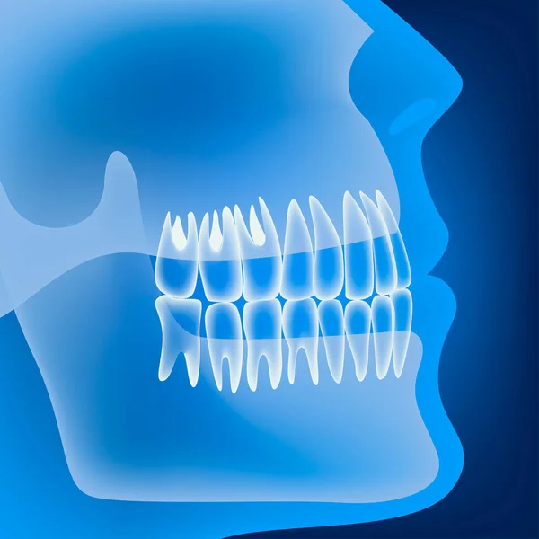 人間の顎と歯を持つ医学のポスター ネオンの背景 ベクターイラスト — ストックベクタ