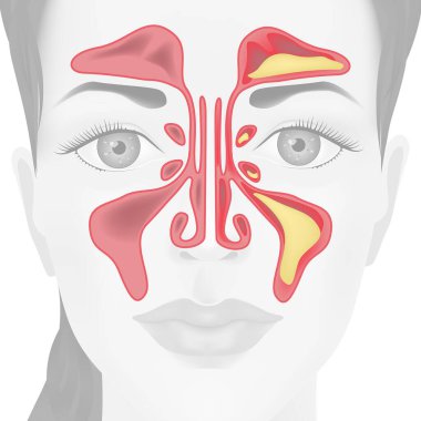 Tıbbi afiş, arka plan, bir kızın yüzü ve sinüsü. Vektör