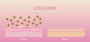 Kolajen, deri alma işleminden önce ve sonra, Cilt Koruma Vektörü