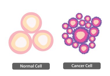 Normal Hücre Kanser Hücresine Karşı, normal büyüme kontrolü kaybı, sağlıklı doku ve tümör, vektör çizimi.