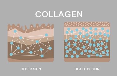 Kolajen, Koruma Cildi Vektörü