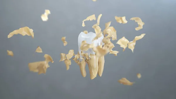 Візуалізація Часткової Дошки Летить Щоб Покрити Зуб Стокове Фото
