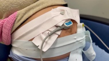 Hamilelik İzleme Fetal Sağlık Değerlendirmesi için Tıbbi Malzeme